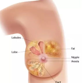 ব্রেস্ট ক্যান্সারের প্রাথমিক লক্ষণ
